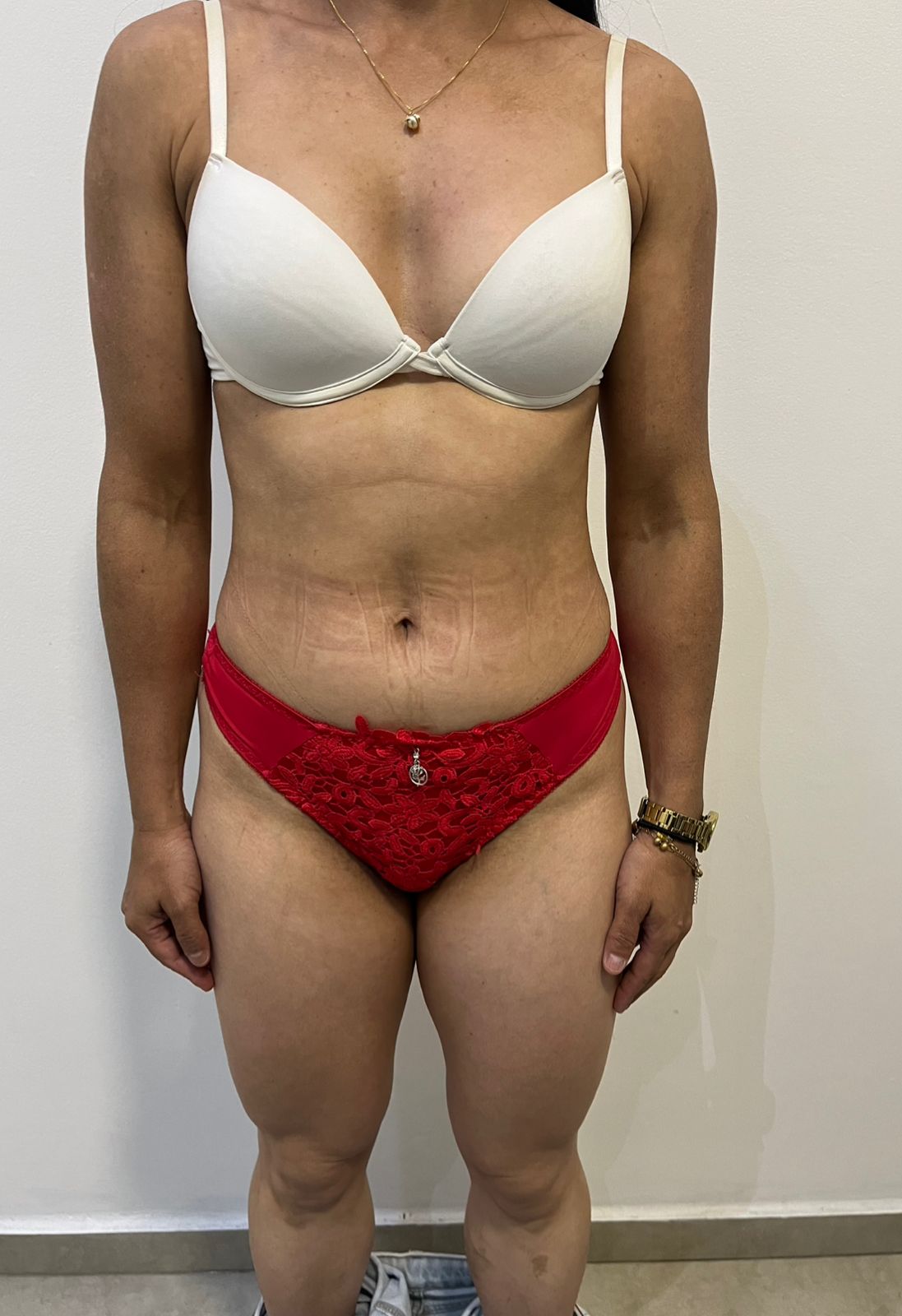 Alexandra Rocha antes