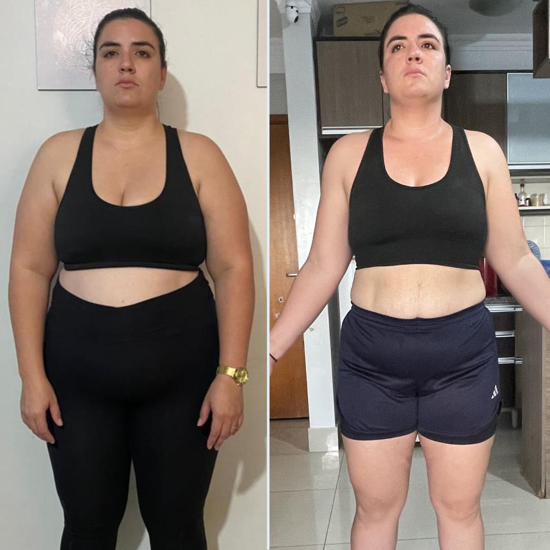 Karol Bezerra depois