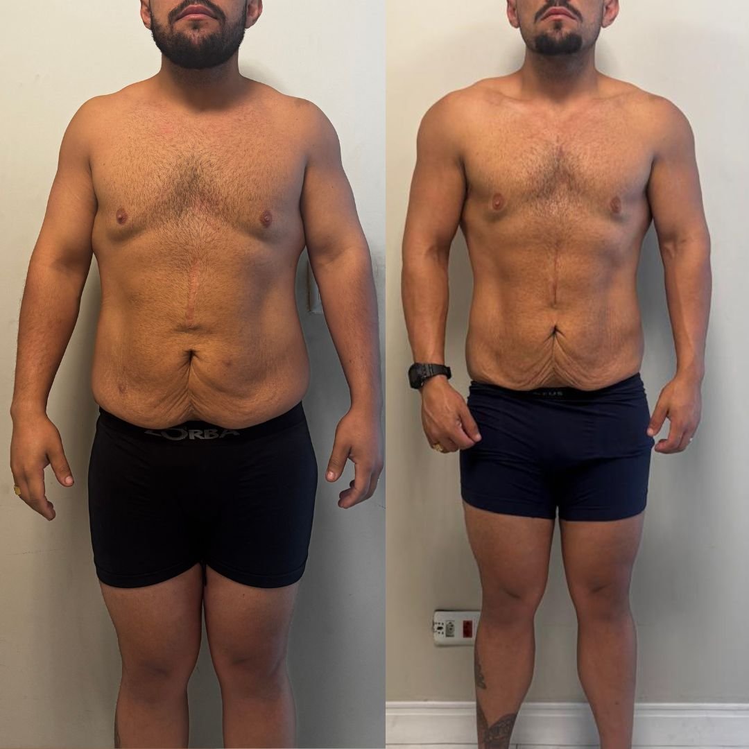 Antes e depois aluno 5